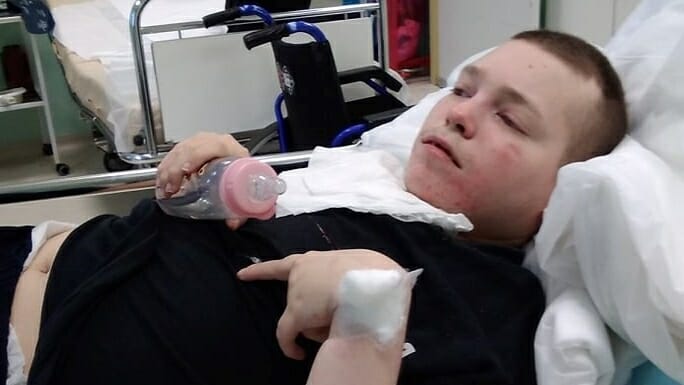 Jakubova ťažká choroba
